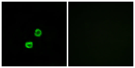 GCNT7 Rabbit Polyclonal Antibody