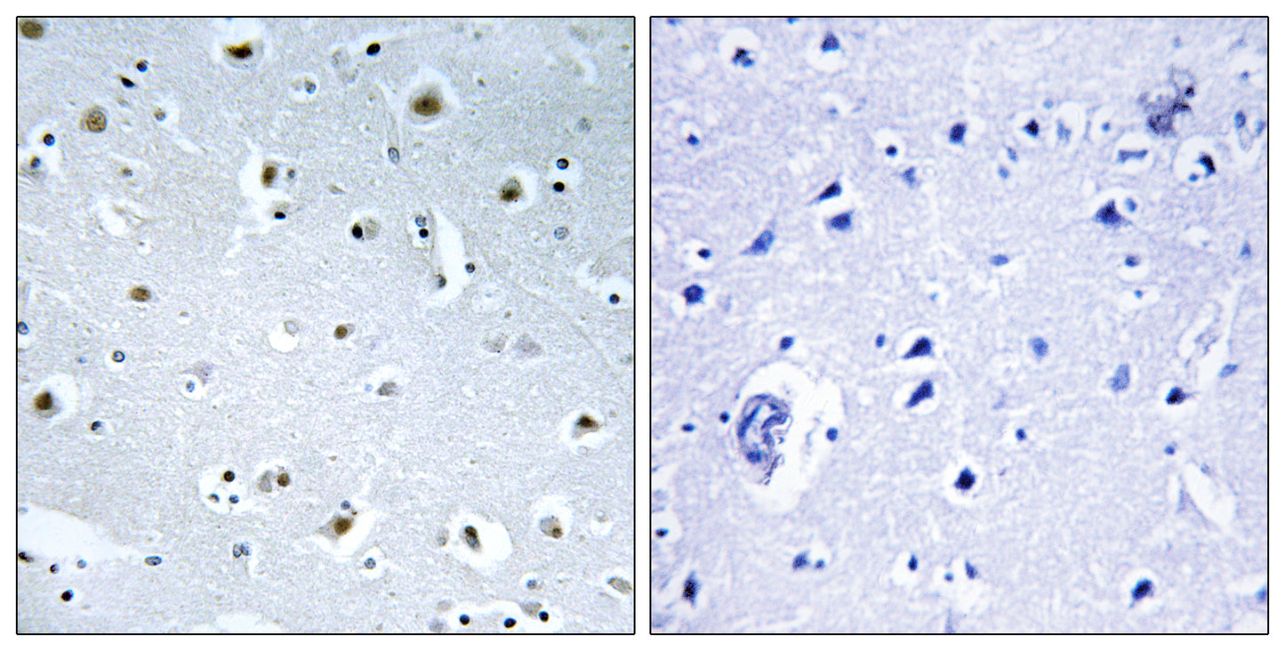 GCP3 Rabbit Polyclonal Antibody
