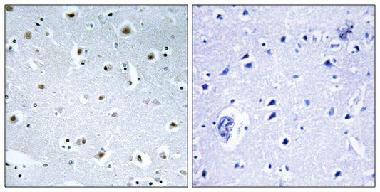 GCP3 Rabbit Polyclonal Antibody