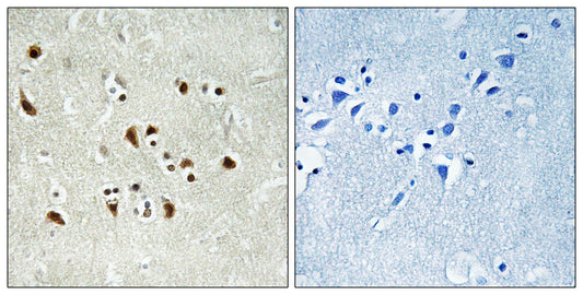 GCP6 Rabbit Polyclonal Antibody
