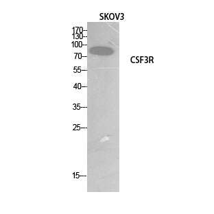 G-CSFR Rabbit Polyclonal Antibody