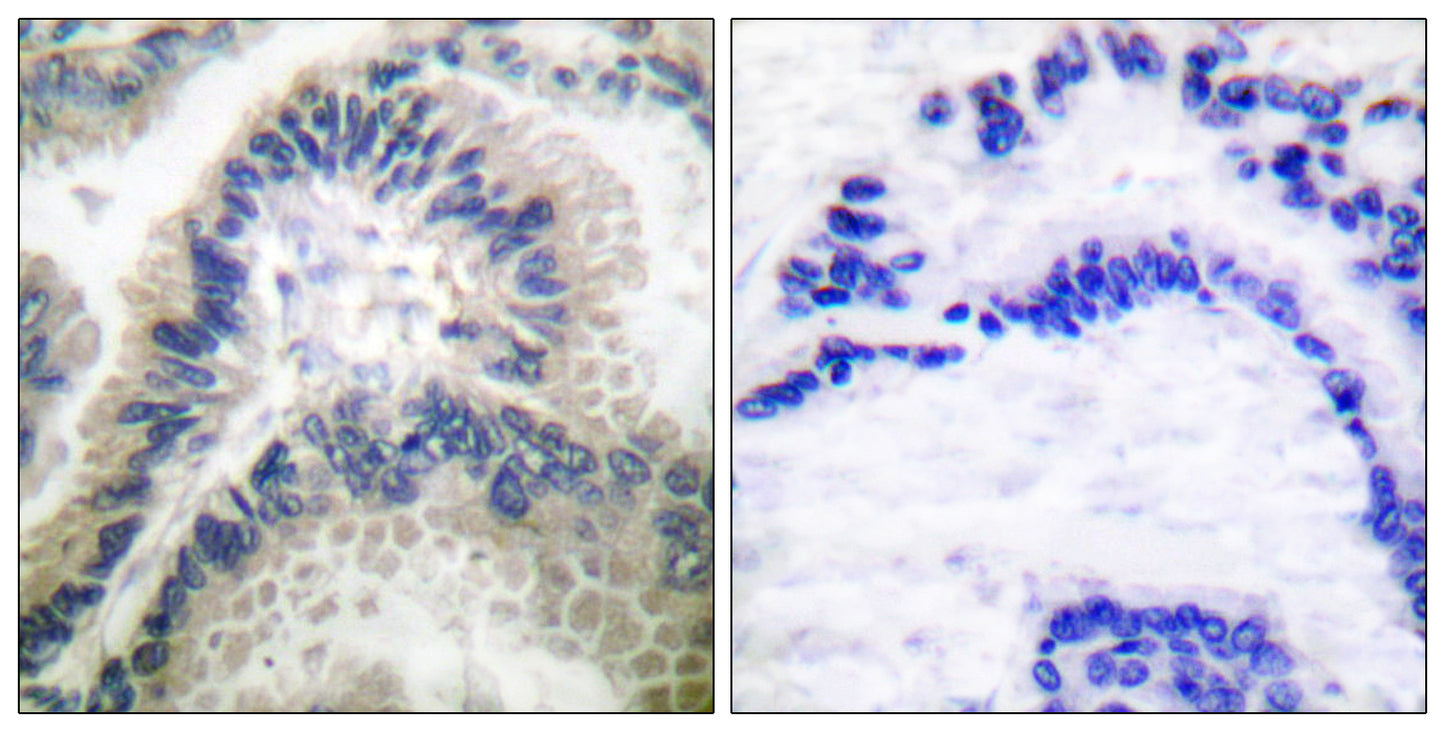 GCS-β-1 Rabbit Polyclonal Antibody