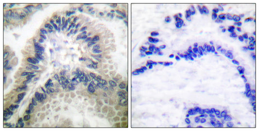 GCS-β-1 Rabbit Polyclonal Antibody