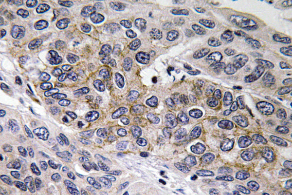 GCS-β-2 Rabbit Polyclonal Antibody