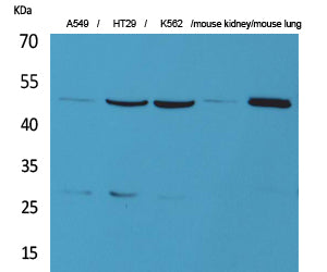 GDI-2 Rabbit Polyclonal Antibody