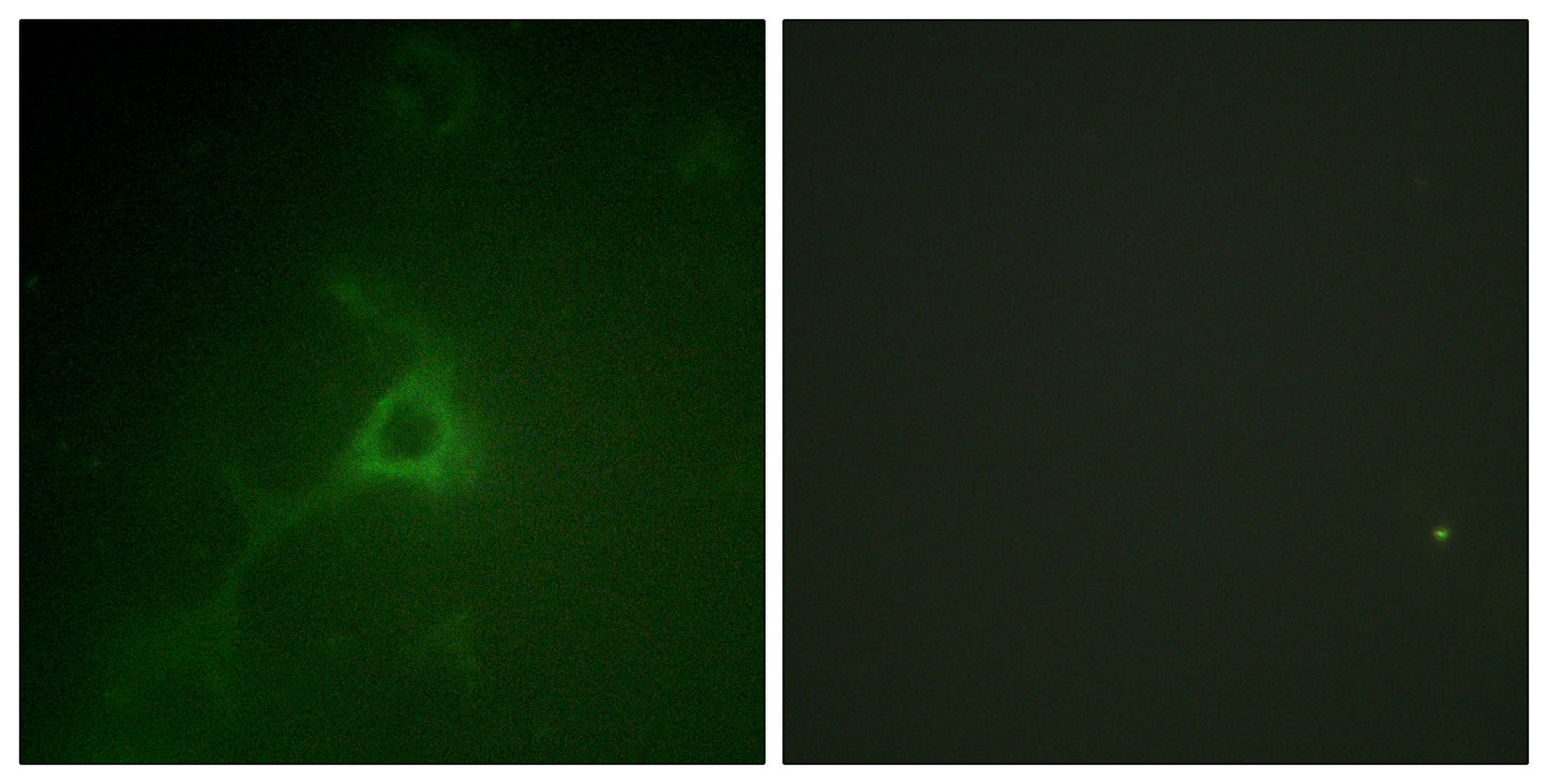 GFAP Rabbit Polyclonal Antibody