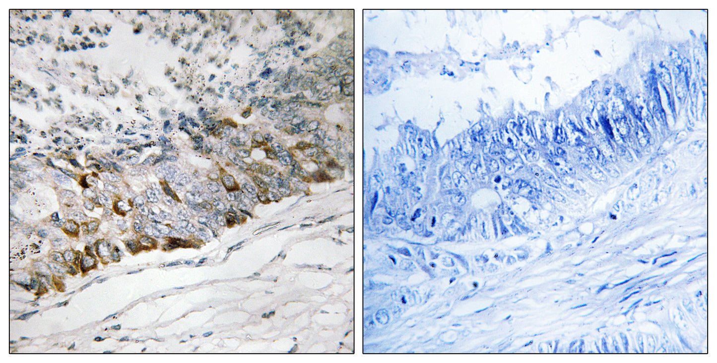 GFRP Rabbit Polyclonal Antibody