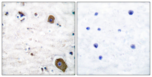 GFRα-1 Rabbit Polyclonal Antibody