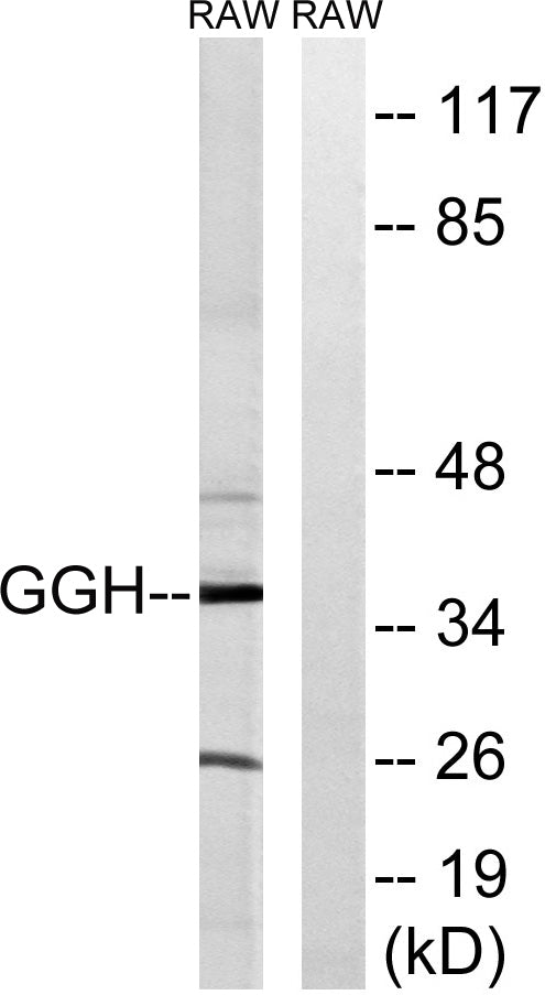 GGH Rabbit Polyclonal Antibody