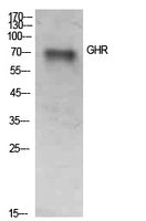 GHR Rabbit Polyclonal Antibody
