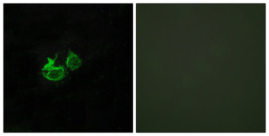 GHRH-R Rabbit Polyclonal Antibody