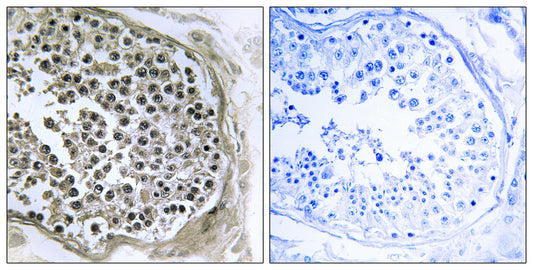 GIDRP88 Rabbit Polyclonal Antibody