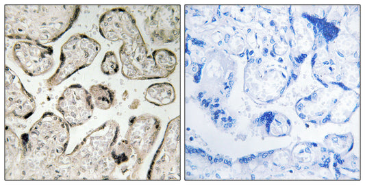 GIMAP5 Rabbit Polyclonal Antibody