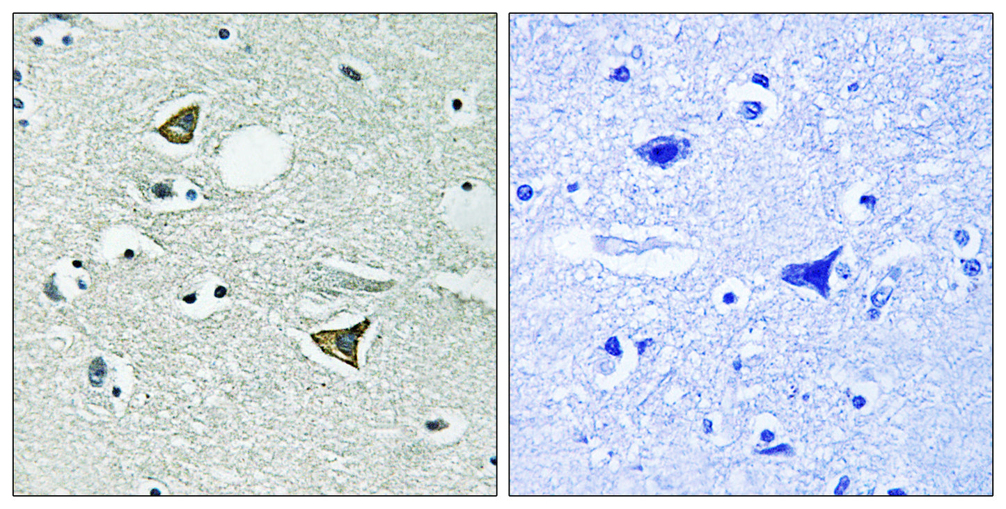 Girdin Rabbit Polyclonal Antibody