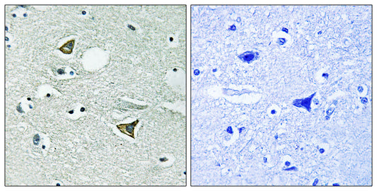 Girdin Rabbit Polyclonal Antibody