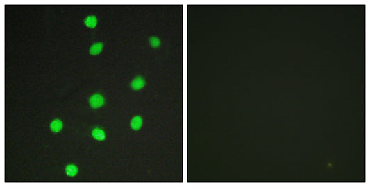 GLI-3 Rabbit Polyclonal Antibody