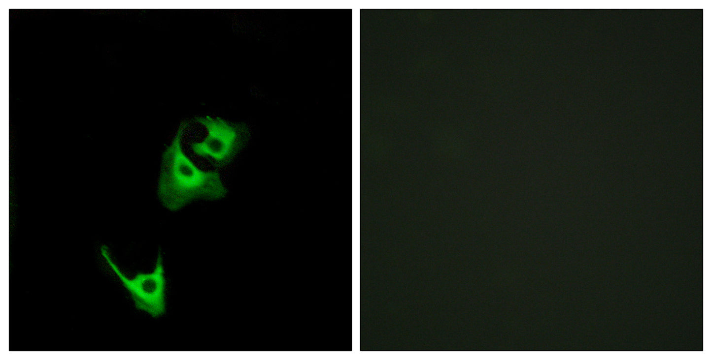 GLP-1R Rabbit Polyclonal Antibody