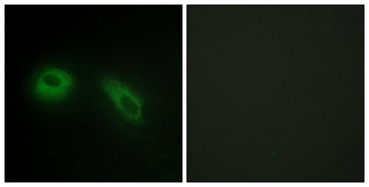 Glucosidase IIβ Rabbit Polyclonal Antibody