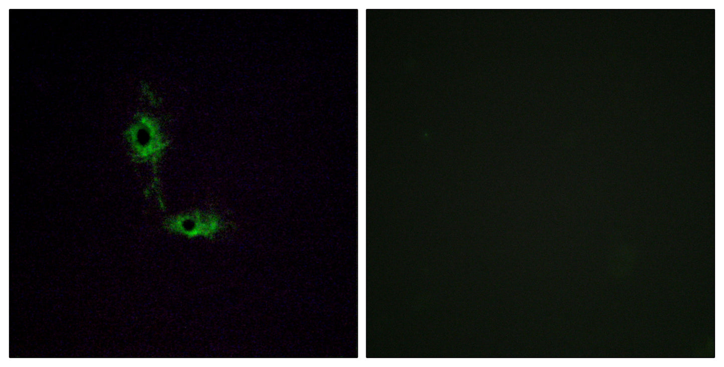 GluR-1 Rabbit Polyclonal Antibody