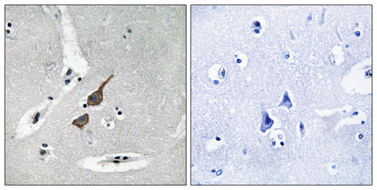 GluR-δ1 Rabbit Polyclonal Antibody
