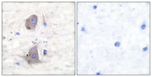 Glut1 Rabbit Polyclonal Antibody