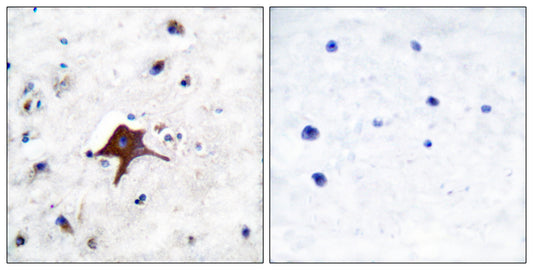 Glut3 Rabbit Polyclonal Antibody