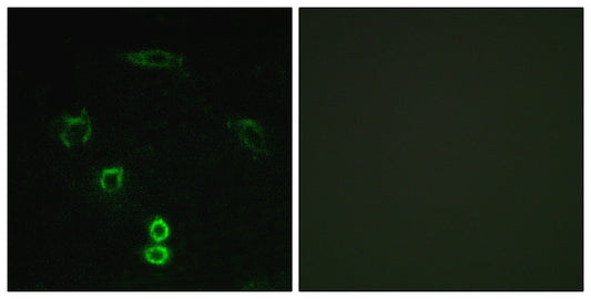 Glycerate Kinase Rabbit Polyclonal Antibody