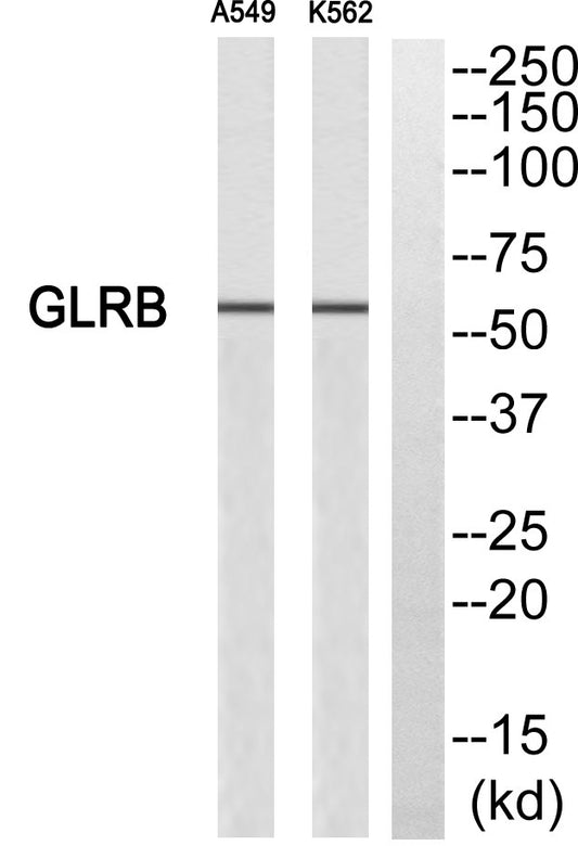 GlyRβ Rabbit Polyclonal Antibody