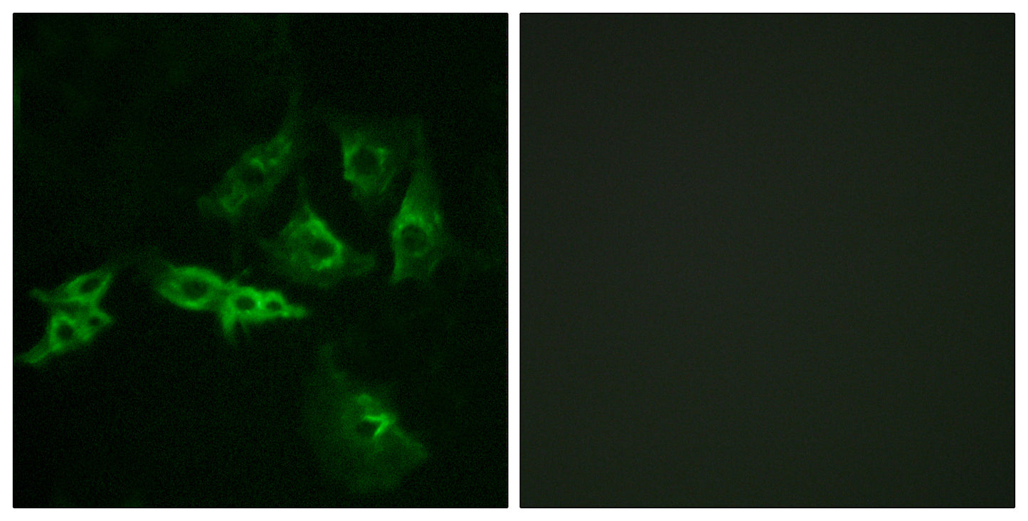 GnRH-R Rabbit Polyclonal Antibody