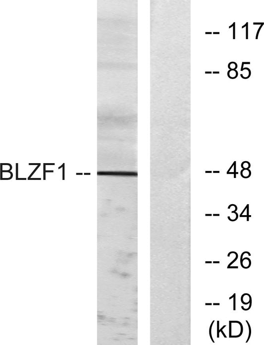 Golgin 45 Rabbit Polyclonal Antibody