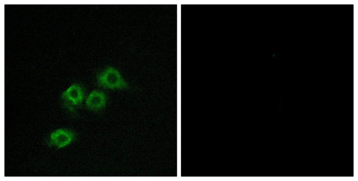 GPR1 Rabbit Polyclonal Antibody