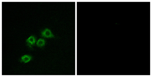 GPR1 Rabbit Polyclonal Antibody