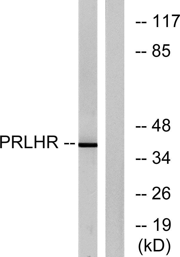 GPR10 Rabbit Polyclonal Antibody