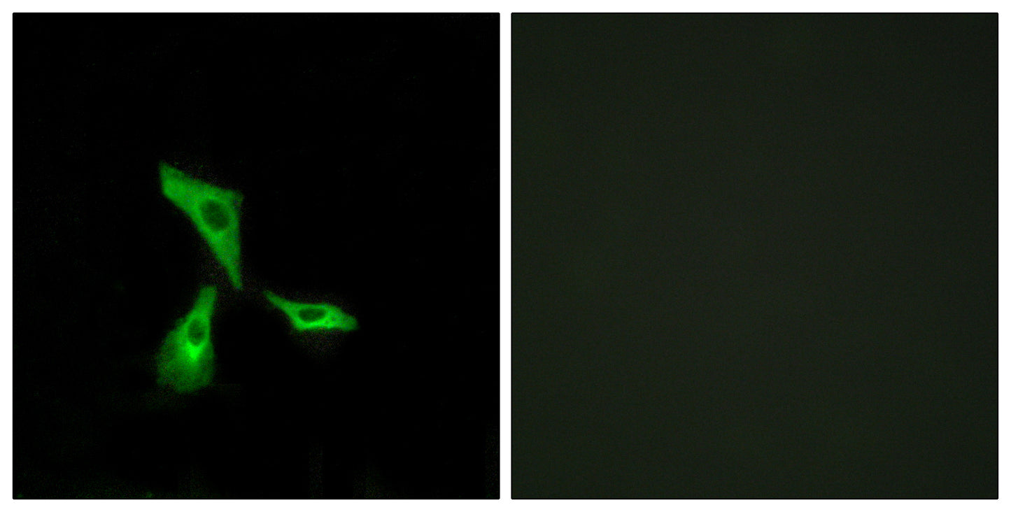 GPR101 Rabbit Polyclonal Antibody