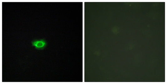 GPR108 Rabbit Polyclonal Antibody