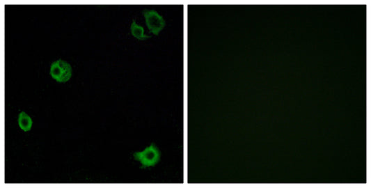 GPR110 Rabbit Polyclonal Antibody