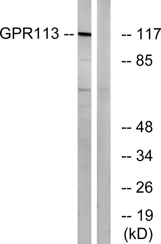 GPR113 Rabbit Polyclonal Antibody