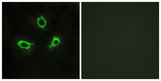 GPR115 Rabbit Polyclonal Antibody