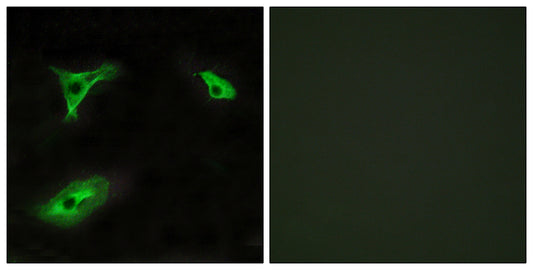 GPR116 Rabbit Polyclonal Antibody