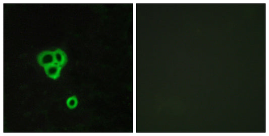 GPR119 Rabbit Polyclonal Antibody