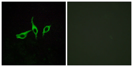 GPR120 Rabbit Polyclonal Antibody