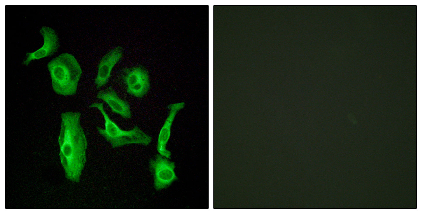 GPR133 Rabbit Polyclonal Antibody