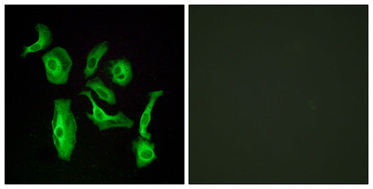 GPR133 Rabbit Polyclonal Antibody