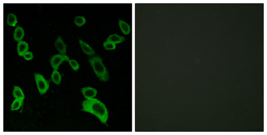GPR139 Rabbit Polyclonal Antibody