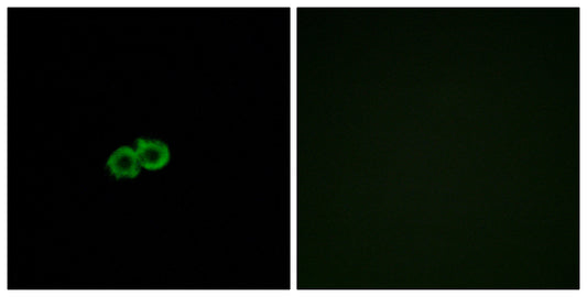 GPR142 Rabbit Polyclonal Antibody