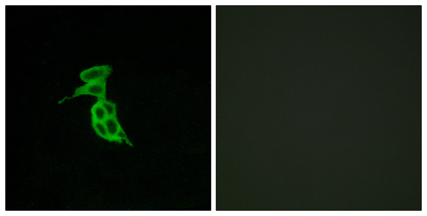 GPR143 Rabbit Polyclonal Antibody