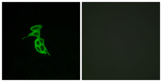 GPR143 Rabbit Polyclonal Antibody