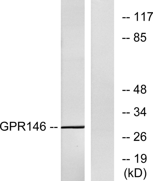 GPR146 Rabbit Polyclonal Antibody
