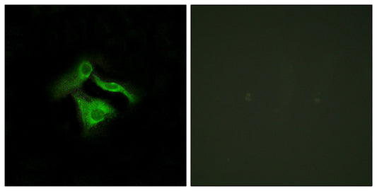 GPR149 Rabbit Polyclonal Antibody