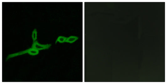 GPR15 Rabbit Polyclonal Antibody